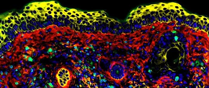 癌症真的能预防？！新研究揭示如何激活自然杀伤细胞