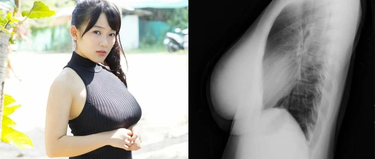 日本女星为了证明胸是真的，去拍了X光照片